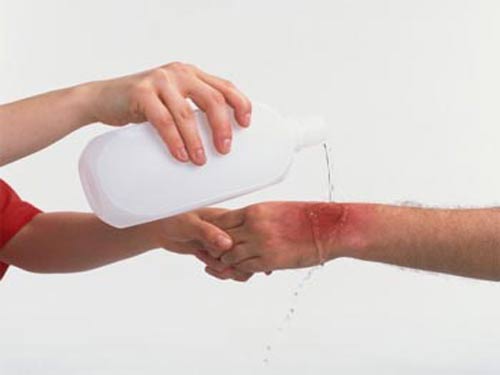 CÁC BƯỚC SƠ CỨU KHI BỊ BỎNG